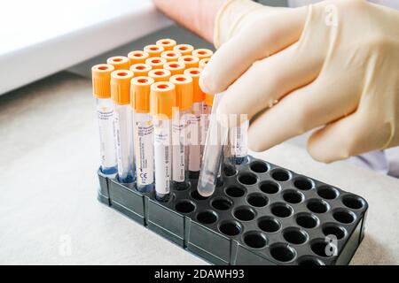 Medizinische Vakuumröhrchen mit orangefarbener Kappe in einem Ständer. Krankenschwestern arbeiten im Labor. Stockfoto