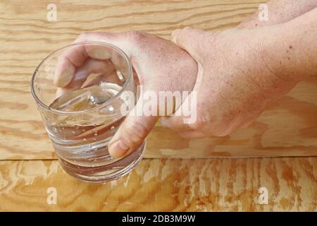 Eine Frau mit Parkinson schüttelt ihre Hände so stark, dass sie kein Glas mehr halten kann. Stark zitternde Hände einer älteren Frau Stockfoto