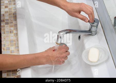 Ein Mann wäscht eine Wunde an der Hand unter einem Wasserfluss im Waschbecken Stockfoto