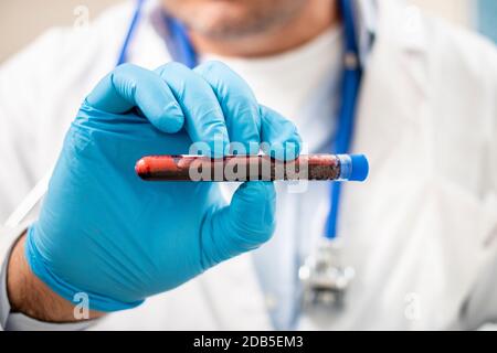 Ansicht eines Arztes, der eine fiktive, möglicherweise infizierte Reagenzglasblutprobe hält. Stockfoto