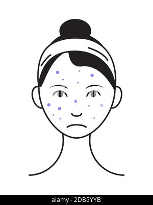 Symbolvektor für Hautausschlag. Verärgert Mädchen mit Pickel, vor Ort auf Problemhaut. Info-Grafik von Akne in Umriss Stil Illustration isoliert auf weißem Hintergrund. Stock Vektor