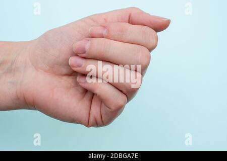 Konzept für natürliche Nägel, rohe Nägel. Nahaufnahme einer kaukasischen weiblichen Hand mit natürlichen unpolierten Nägeln, überwuchert Nagelhaut auf blauem Hintergrund, oben V Stockfoto