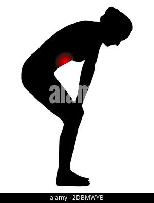 Frau nach vorne gebeugt wegen Übelkeit Stockfoto