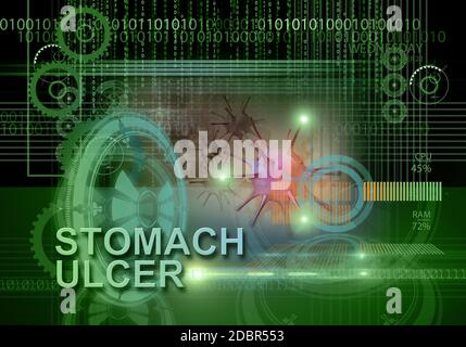 hi-Tech Infografiken von Magengeschwüren in 3d-Software gemacht Stockfoto