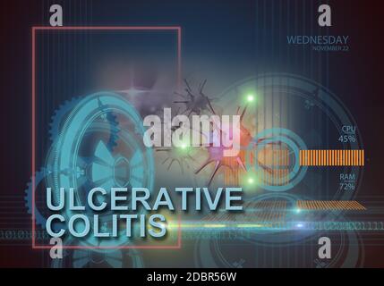 hi-Tech Infografiken von Colitis ulcerosa in 3d-Software hergestellt Stockfoto