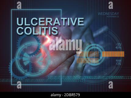 hi-Tech Infografiken von Colitis ulcerosa in 3d-Software hergestellt Stockfoto