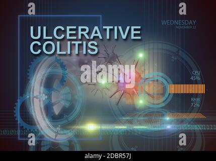 hi-Tech Infografiken von Colitis ulcerosa in 3d-Software hergestellt Stockfoto