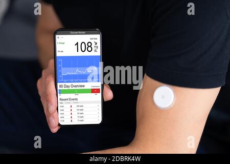 Continuous Glucose Monitor Blutzucker-Test Smartphone App Stockfoto