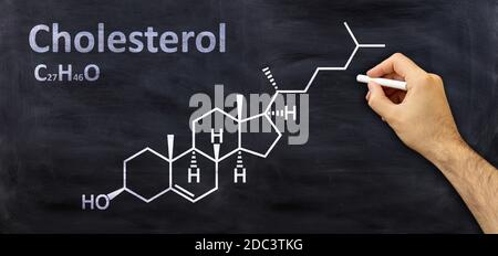 Cholesterin strukturelle chemische Formel, Handzeichnung mit einer Kreide auf einer Tafel, Schule Chemie-Klasse. Stockfoto