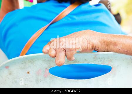 Nahaufnahme Hand von alten Mann an Lepra auf der Rückenlehne von Kunststoff-Stuhl leiden. Stockfoto