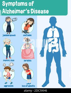 Symptome der Alzheimer-Krankheit Infografik Illustration Stock Vektor