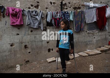 Idlib, Syrien. November 2020. Fatima Ahmad Mostafa, ein 9-jähriges syrisches Mädchen, wurde bei einem Bombenanschlag in ihrem Dorf verletzt, wodurch ihr Bein komplett amputiert wurde. Heute geht Fatima Ahmad Mostafa drei Meilen auf einem Fuß mit Hilfe ihrer Krücken zur Schule. Fatima lebt mit ihrer Familie in einem zerstörten Gebäude am Stadtrand von Idlib, nachdem sie aufgrund der Bombardierungen der Assad-Regierung aus ihrem Dorf vertrieben wurden. Kredit: SOPA Images Limited/Alamy Live Nachrichten Stockfoto