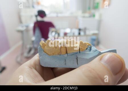 Moderne Nylon-Zahnprothese in den Händen eines Arztes Stockfoto