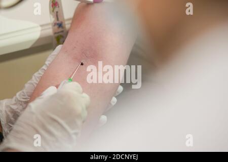 Hand einer Krankenschwester, die eine medizinische Nadel für Blut einführt Extraktion aus der Vene auf der Hand eines Patientin mit einem Blutstropfen, der oben sichtbar ist Stockfoto