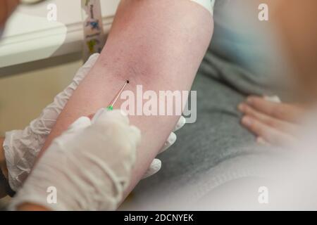 Hand einer Krankenschwester, die eine medizinische Nadel für Blut einführt Extraktion aus der Vene auf der Hand eines Weibliche Patientin mit einem winzigen Tropfen Blut sichtbar Stockfoto