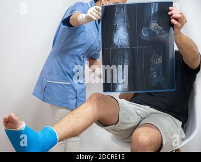 Ärztin in einem blauen medizinischen Gewand erklärt einem männlichen Patienten mit gebrochenem Bein das Ergebnis einer Röntgenaufnahme. Stockfoto