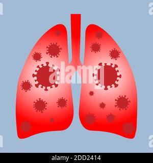Menschliche Lungen, die mit Coronavirus infiziert sind, konzeptueller Vektor Stock Vektor