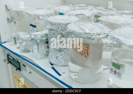 Konservierte menschliche Gehirnbecher auf dem Tisch im Labor Stockfoto