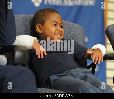 KEIN FILM, KEIN VIDEO, KEIN Fernsehen, KEIN DOKUMENTARFILM - Zion Harvey, 8, aus Baltimore, zeigt seine neuen Hände und lächelt bei einer Pressekonferenz im Kinderkrankenhaus von Philadelphia am Dienstag, 28. Juli 2015. Zion, der als zweijähriger seine Hände und Füße durch eine bakterielle Erkrankung verlor, hatte Anfang Juli 2015 bei CHOP eine Doppelhandtransplantation, die erste pädiatrische Doppelhandtransplantation. Im Hintergrund ist sein Stiefvater Kevon Gant. Foto von Clem Murray/Philadelphia Inquirer/TNS/ABACAPRESS.COM Stockfoto