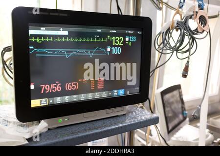 Elektrokardiograph (EKG oder EKG) in der Notaufnahme eines Krankenhauses, schwarzer Monitor mit Herzfrequenz und Puls, COVID-19 Coronavirus USA Pandemie Stockfoto