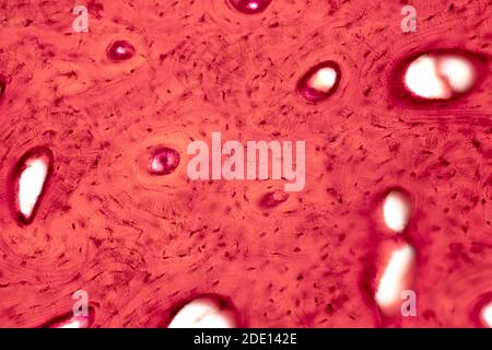 Menschliches, kompaktes Knochengewebe, leichte Mikrograph Stockfoto