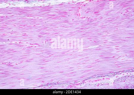 Menschlicher glatter Muskel, leichte Mikrograph Stockfoto