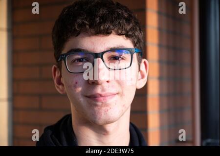 Porträt eines kaikasischen Jungen in der Pubertät: Auf der Gesichtshaut erkennen wir kleine Pickel, rote Flecken, Akne. Stockfoto