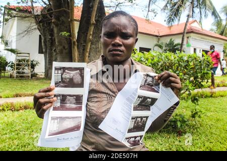 Irine Akinyi, 28 Jahre alt, Opfer einer Bleivergiftung im Dorf Uwino Uhuru in Changamwe sah, wie sie ihre Röntgenbilder nach einem Interview mit der Presse zeigte. Sie leidet an Nieren- und Schilddrüsenproblemen als Folge einer Bleivergiftung durch eine Bleibatterieschmelzfirma in ihrer Nachbarschaft. Das Unternehmen wurde bisher geschlossen, aber der Schaden, der zurückgelassen wurde, war tödlich. In einem Landmark-Urteil Anfang dieses Jahres wurden die Regierung und die beiden privaten Investoren angewiesen, den Opfern 1.3 Milliarden Ksh zu zahlen, was 12 Millionen US-Dollar als Entschädigung entspricht, was die Regierung durch die zu zahlen hat Stockfoto