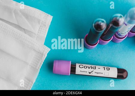 Konzeptfoto für den Ausbruch des Coronavirus. Positive Blutprobe. Medizinische Gesichtsmaske, Reagenzgläser mit Blutprobe. Stockfoto