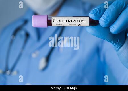 Der Arzt zeigt eine Coronavirus-negative Blutprobe. Covid-19-Konzept. Stockfoto