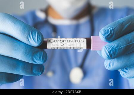 Arzt hält Reagenzglas mit positiver Coronavirus-Testblutprobe. Covid-19-Konzept. Stockfoto