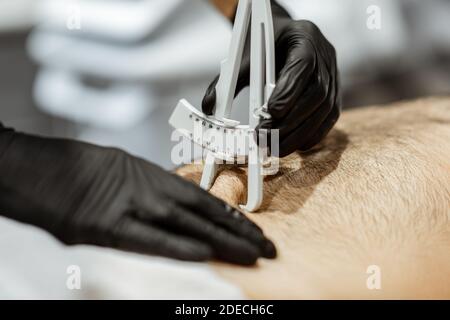 Bestimmung der Menge an Talg auf männlichen Bauch mit medizinischen Caliper, Nahaufnahme Stockfoto