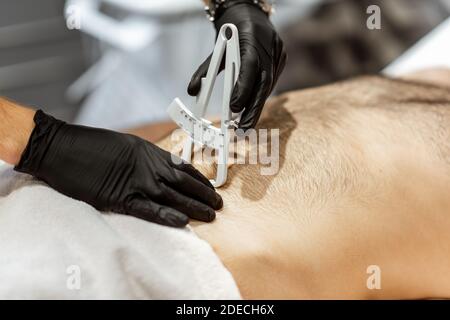 Bestimmung der Menge an Talg auf männlichen Bauch mit medizinischen Caliper, Nahaufnahme Stockfoto