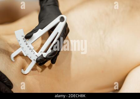 Bestimmung der Menge an Talg auf männlichen Bauch mit medizinischen Caliper, Nahaufnahme Stockfoto