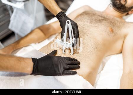 Bestimmung der Menge an Talg auf männlichen Bauch mit medizinischen Caliper, Nahaufnahme Stockfoto