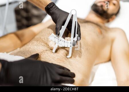 Bestimmung der Menge an Talg auf männlichen Bauch mit medizinischen Caliper, Nahaufnahme Stockfoto