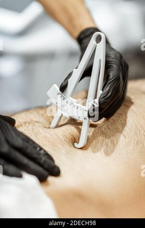 Bestimmung der Menge an Talg auf männlichen Bauch mit medizinischen Caliper, Nahaufnahme Stockfoto