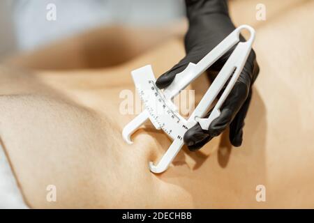 Bestimmung der Menge an Talg auf männlichen Bauch mit medizinischen Caliper, Nahaufnahme Stockfoto