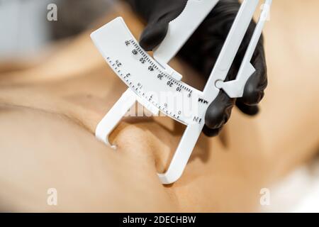 Bestimmung der Menge an Talg auf männlichen Bauch mit medizinischen Caliper, Nahaufnahme Stockfoto