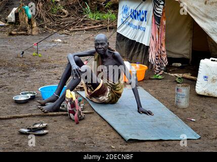 Ein Flüchtling floh wegen der Zusammenstöße zwischen südsudanesischen Regierungstruppen ins Flüchtlingslager Kule in Äthiopien. Gambela, Äthiopien am 15. Juli 2014. Stockfoto