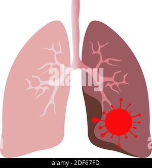 Menschliche Lungen mit rotem Coronavirus-Symbol. Symbol auf weißem Hintergrund. Stock Vektor