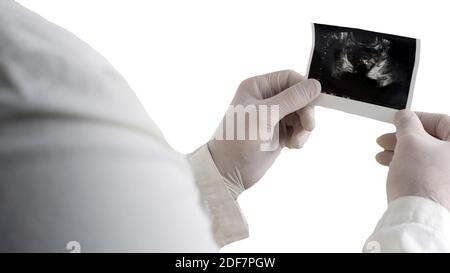 Aufnahme der männlichen Prostata auf weißem isolierten Hintergrund, Ort für Text. Prostatitis männlich Stockfoto