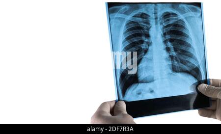 Röntgenaufnahme der Lunge mit Platz für Text für eine Inschrift, Bild der Lunge ist auf weiß isoliert. Stockfoto