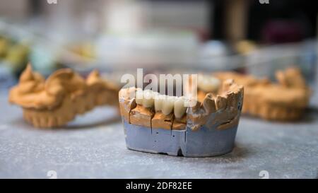 Gipsmodell der Zähne auf einem Arbeitstisch, ein Zahntechniker macht eine Prothese.Zahnprothetik. Stockfoto