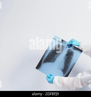 Röntgenfilm von Covid 19 Lungenschäden und Halten durch Arzt Hand in medizinischen Handschuh und PSA oder persönliche Schutzausrüstung Anzug. Studio Shot weißer Hintergro Stockfoto