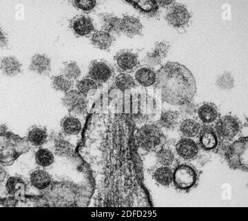 MERS-Coronavirus-Partikel Stockfoto