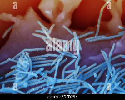 Rasterelektronenmikroskopische Aufnahme von Virionen des menschlichen respiratorischen Synzytialvirus (RSV) (Blau gefärbt) und mit Anti-RSV-F-Protein-/Gold-Antikörpern ( Stockfoto