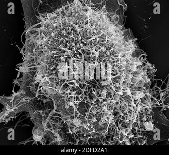Rasterelektronenmikrographie von filamentösen Ebola-Virus-Partikeln, die an und angeschlossen sind Knospen von chronisch infizierten VERO E6-Zellen (15.000fache Vergrößerung) Stockfoto