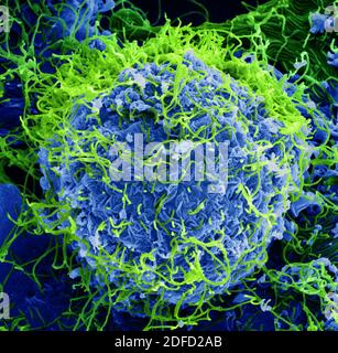 Eingefärbte Rasterelektronenmikroskopie von Ebola-Viruspartikeln (grün), die an der Oberfläche infizierter VERO-E6-Zellen (blau) aufkeimend und befestigt sind. Ima Stockfoto
