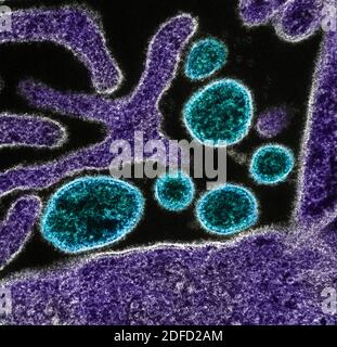 Kolorierte Transmissionselektronenmikrographie von reifen extrazellulären Nipah-Virus-Partikeln (blau) nahe der Peripherie einer infizierten VERO-Zelle (violett).